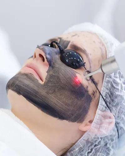 HOLLYWOOD PEEL